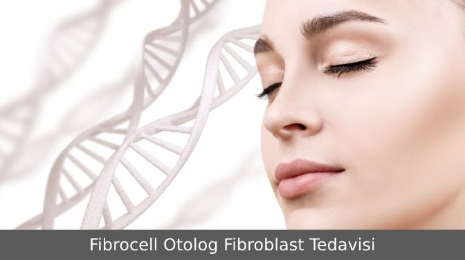 Plazma Fibroblast Tedavisi Örneği