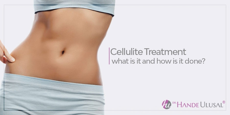 Some Ideas on Your Ultimate Workout Plan To Get Rid Of Cellulite For Good You Need To Know thumbnail