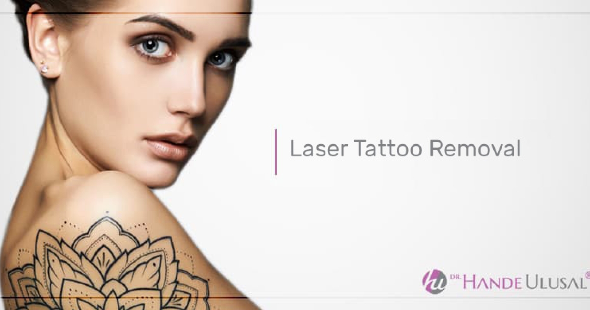 Worlds Fastest Tattoo Removal in Herndon, VA
