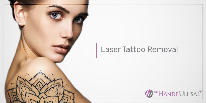 Laser Tattoo Removal Neutral Bay, Sydney | Tattoo Removal Specialists